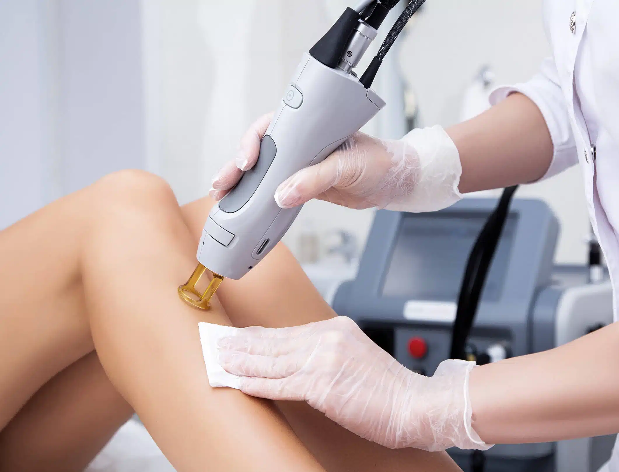 Épilation laser : les bons gestes pour une peau parfaite